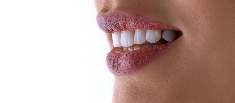 Holiday dental checkups in Matthews, NC